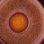 Wurm-Eier im Stuhl des Menschen: Ursachen, Symptome und Behandlungsmöglichkeiten